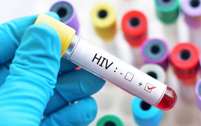 Novo antiviral garante proteção total contra HIV em jovens africanas