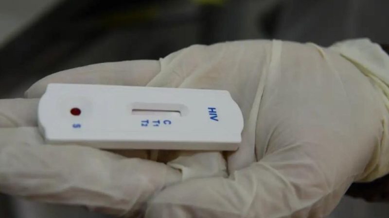 Ministério da Saúde orienta formácias sobre testes para HIV, sífilis e hepatites